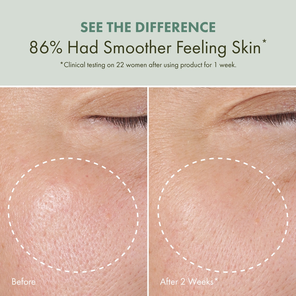 Checks and Balances™ Daily Exfoliating Toner with AHA, BHA and Witch Hazel, 5 fl. oz.