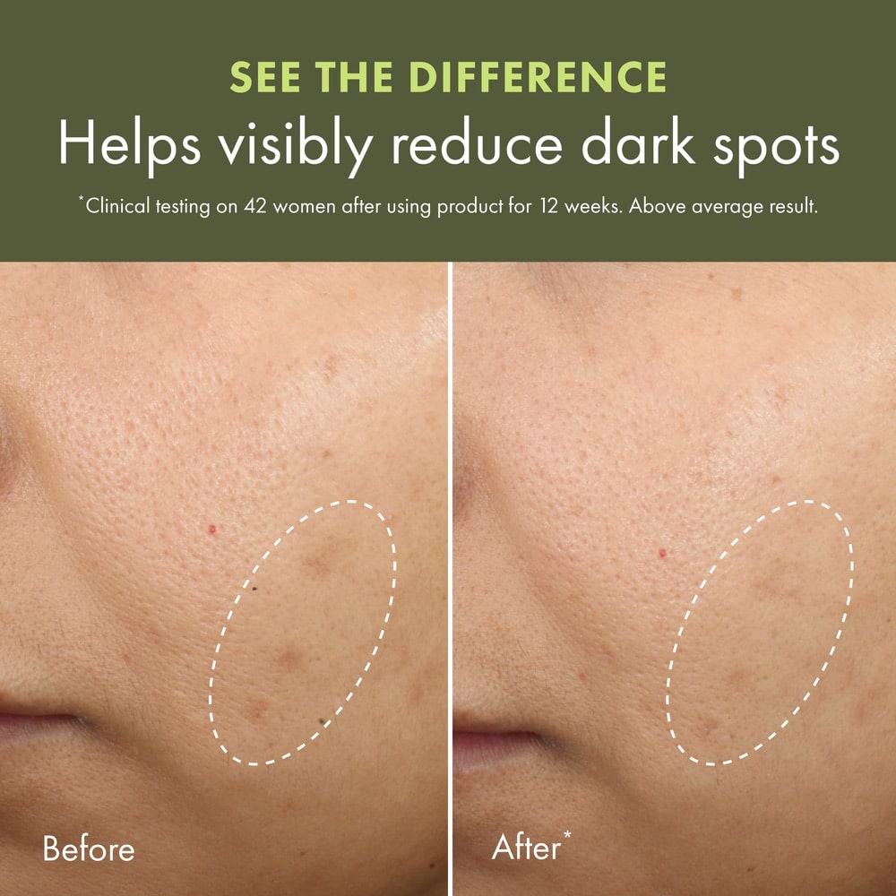 Dr. Weil For Origins™ Mega-Mushroom